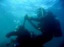 apnea